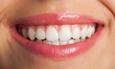Sağlıklı dişler için D vitamini şart