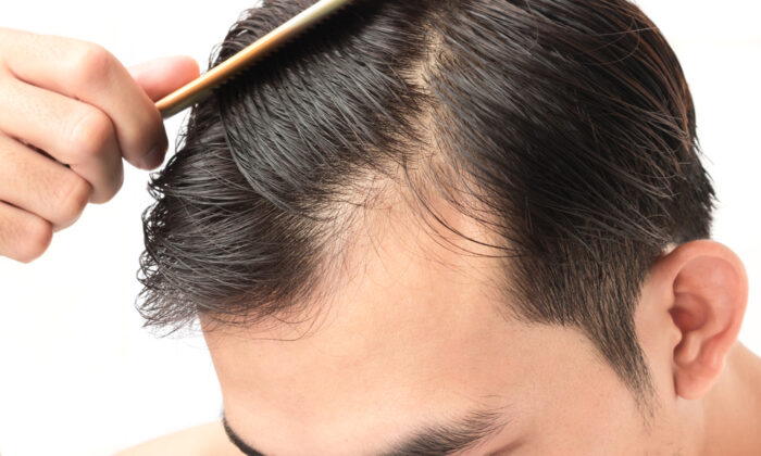 Saçlarımız neden dökülür? İşte saç dökülmesinin 8 nedeni…
