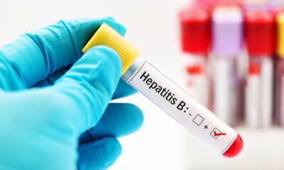 “Türkiye’de yaklaşık 3,5 milyon hepatit B hastası var”