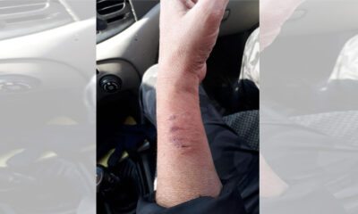HDP’li vekil, kadın polisin kolunu ısırdı