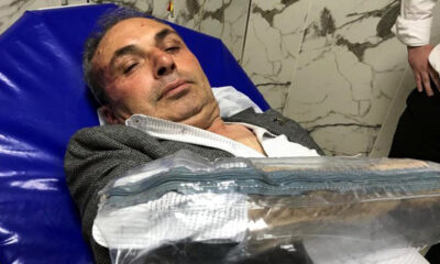CHP’li belediye başkan yardımcısına hain saldırı!