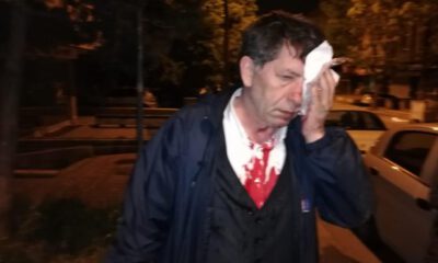 İşte saldırının ardından gazeteci Demirağ’ın ilk yazısı: ‘Korkmuyorum’