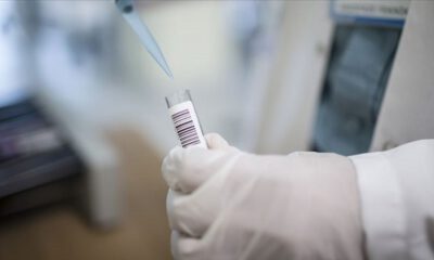 KKTC’de ilk koronavirüs vakası tespit edildi