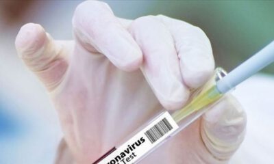 Uludağ Üniversitesinde Kovid-19 aşı denemelerine başlandı