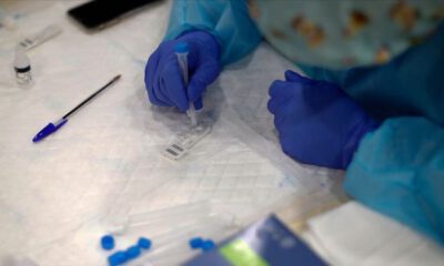 ABD’li ilaç firmasına Kovid-19 antikor testi için ‘acil kullanım’ yetkisi