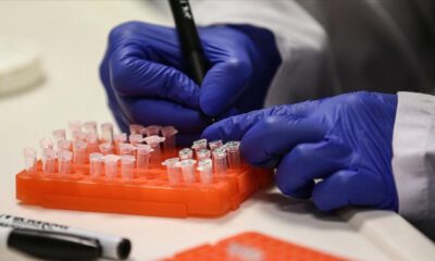 Türkiye’de 12 ‘Kovid-19 aşı’ çalışması yürütülüyor