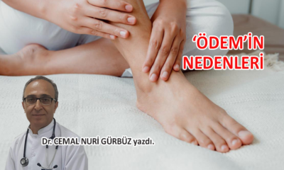 ÖDEM