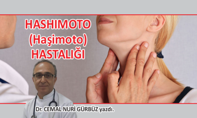 HASHIMOTO (Haşimoto) HASTALIĞI