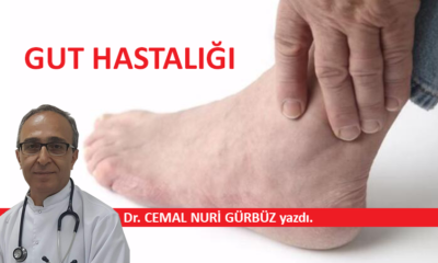 Gut Hastalığı