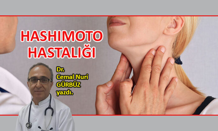 Hashimoto hastalığı