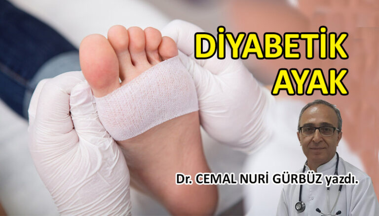 Diyabetik Ayak